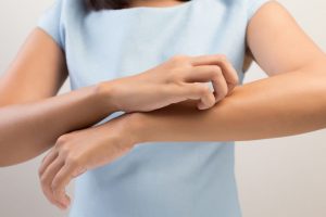¿Qué es la dermatitis atópica y cómo se trata? - Trucos de belleza caseros